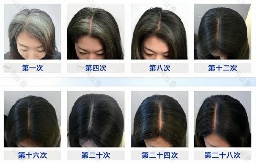 用户反馈效果二