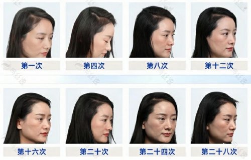 用户反馈效果三