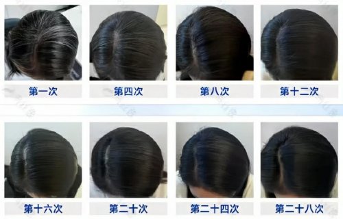 用户反馈效果四